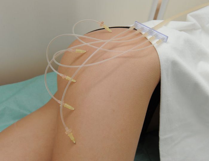 Озонотерапия - Санаторий «Солнечный» Кисловодск Озонотерапия - Санаторий «Солнечный» Кисловодск